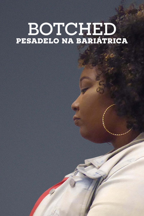 Assistir Botched: Pesadelo na Bariátrica